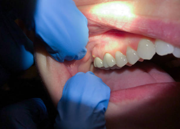 Best Pediatric Emergency Dentist in Palermo, CA