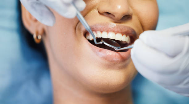 Best Emergency Dental Care for Broken or Chipped Teeth in Palermo, CA